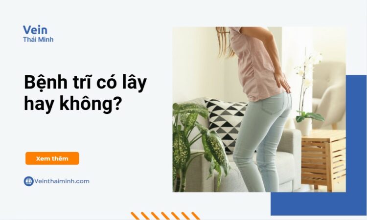 Bệnh trĩ có lây hay không? Sự thật ít ai biết