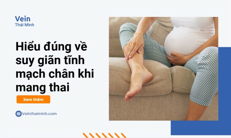 Hiểu đúng về suy giãn tĩnh mạch chân khi mang thai