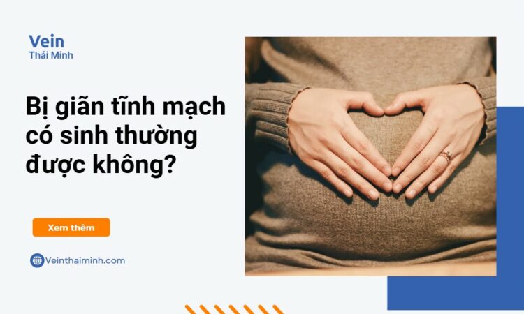 Giải đáp: Bị suy giãn tĩnh mạch có sinh thường được không?