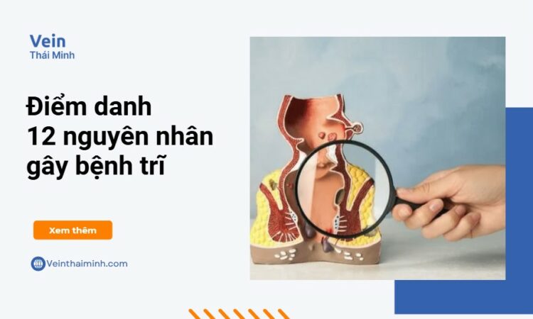 Tìm hiểu đầy đủ 12 nguyên nhân hàng đầu gây bệnh trĩ