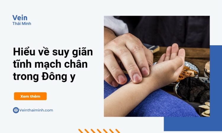 Các phương pháp chữa giãn tĩnh mạch chân bằng đông y Các phương pháp chữa giãn tĩnh mạch chân bằng đông y