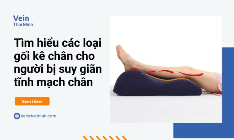Tìm hiểu các loại gối kê chân cho người bị suy giãn tĩnh mạch