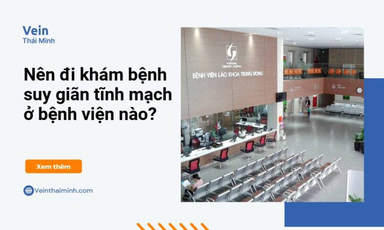 6 địa chỉ khám suy giãn tĩnh mạch uy tín – Người bệnh nên tham khảo