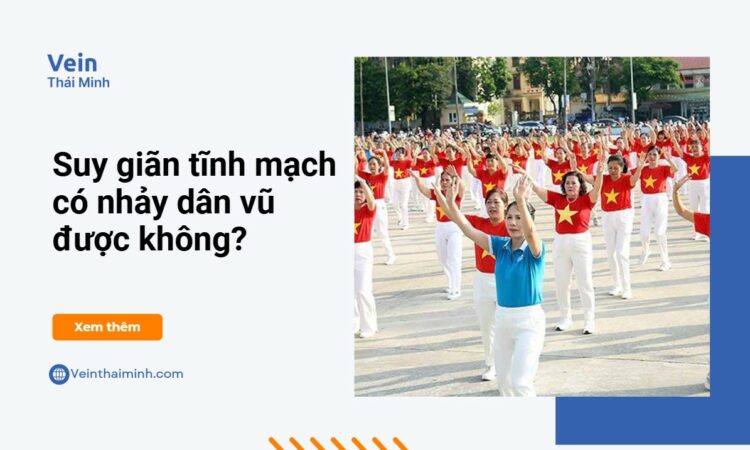 Bị suy giãn tĩnh mạch có nhảy dẫn vũ được không? Bị suy giãn tĩnh mạch có nhảy dẫn vũ được không?