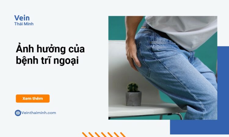 Những ảnh hưởng đáng nói của bệnh trĩ ngoại
